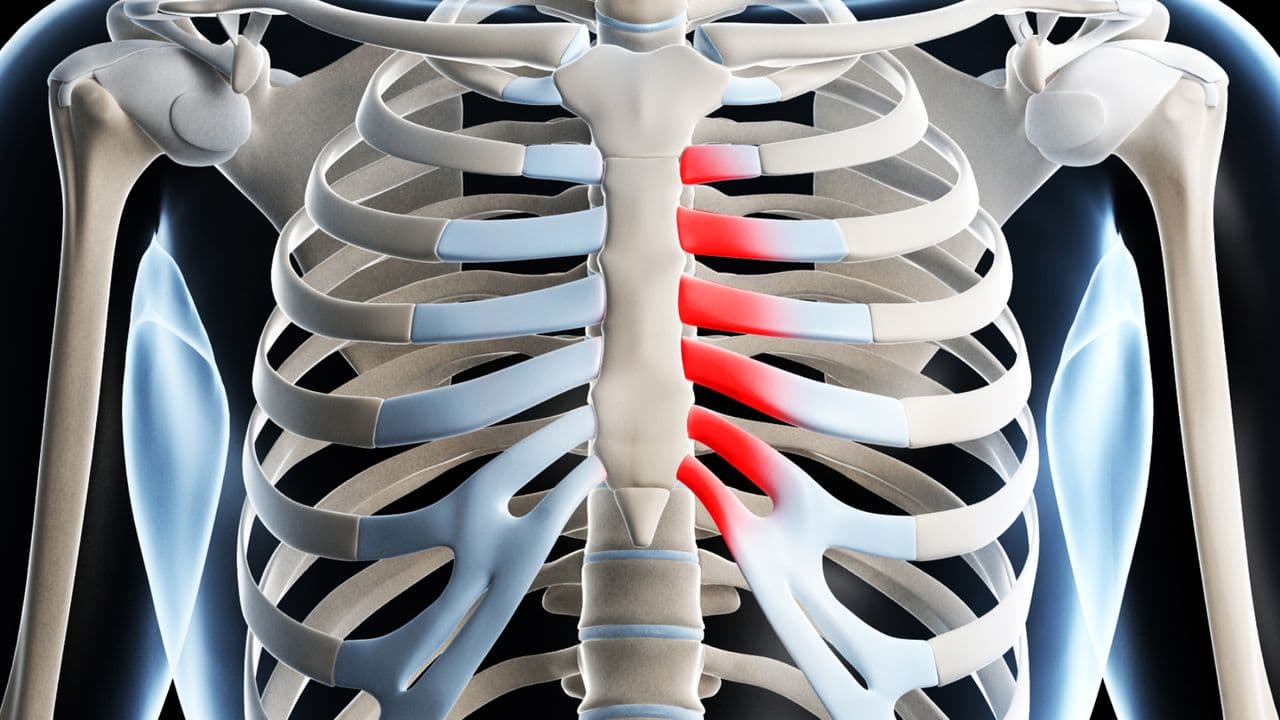 Costochondritis Chiropractor in San Antonio, TX | Dr. Dan Foss