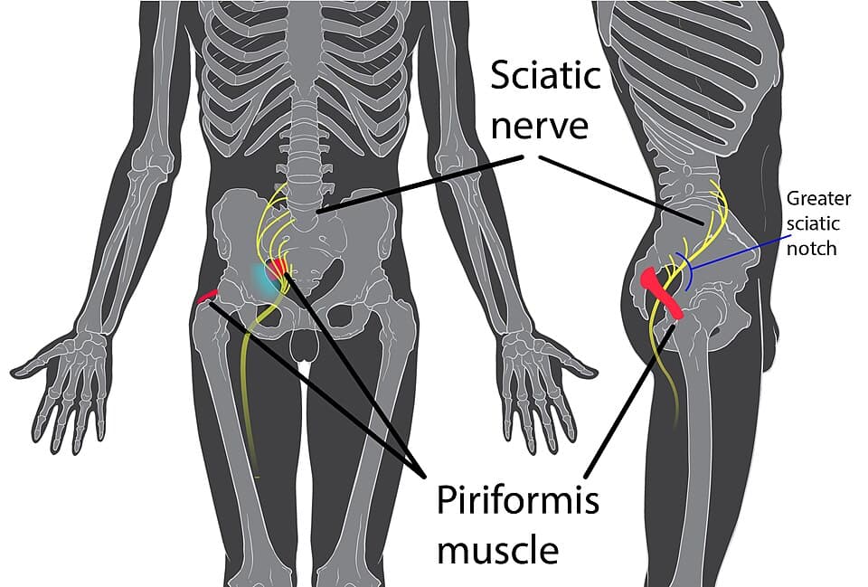 Piriformis syndrome muscle anatomy diagram - chiropractor San Antonio TX