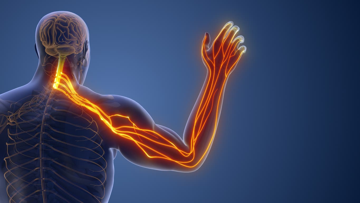 Radiculopathy nerve root compression treatment - chiropractor San Antonio TX