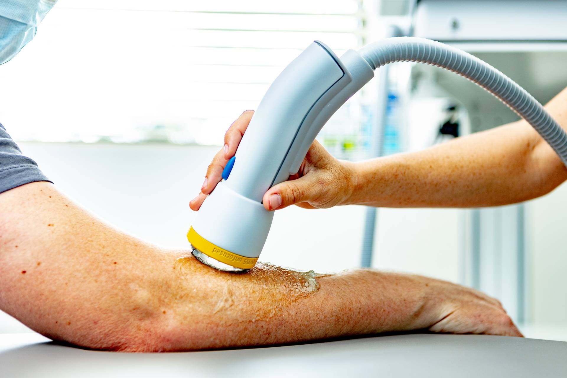 SoftWave Therapy in San Antonio, TX | Dr. Dan Foss